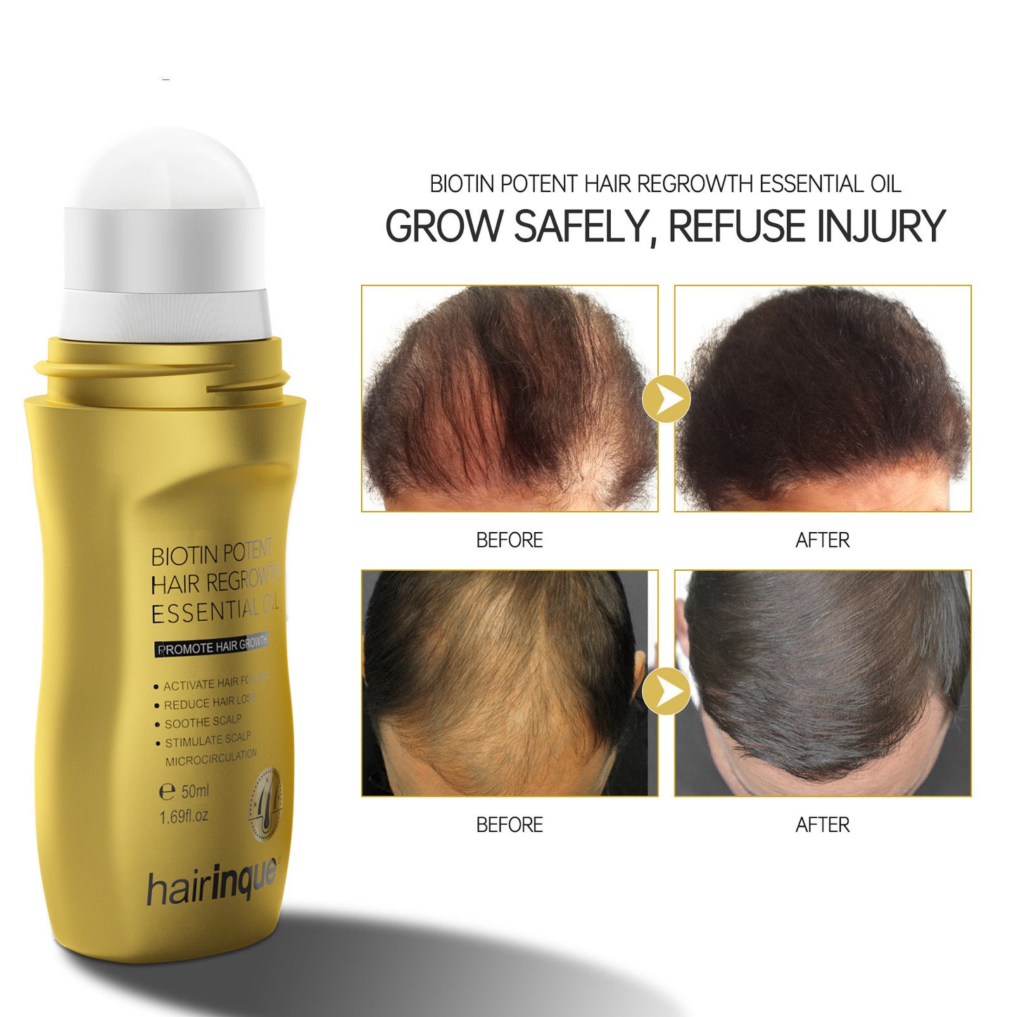 Growth Density Hair Care Scalp Nutrition Roll-On Serum